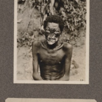 Leper at Euli, Ikelemba River, upper Congo